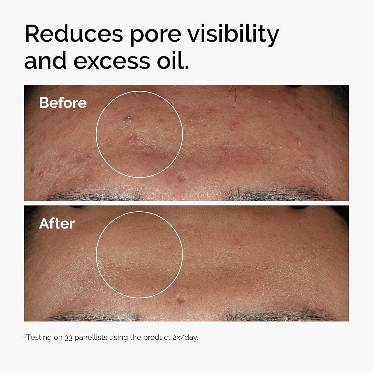 The Ordinary Niacinamide 10% + Zinc 1% Serum – 30ml